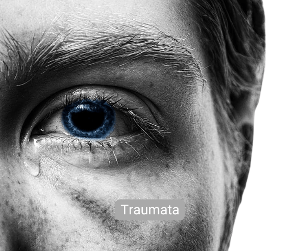 Traumatherapie Hypnose Hannover Gehrden